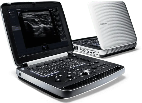 Samsung HM70 EVO Portable Ultrasound Machine