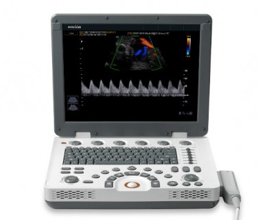 Samsung Medison MySono U6 Ultrasound Machine