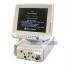 Datex Ohmeda S/5 Anesthesia Monitor