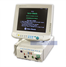 Datex Ohmeda S/5 Anesthesia Monitor