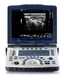 GE Logiq V2 Ultrasound Machine