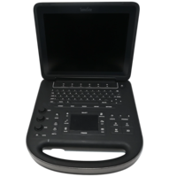 SonoSite Edge Ultrasound Machine